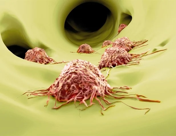 Descubren nueva pista sobre cómo y por qué se propagan las células cancerosas