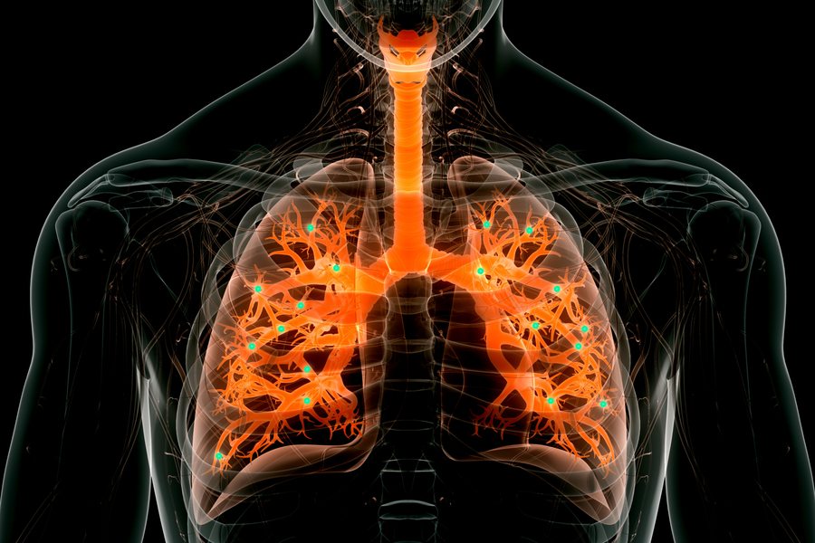 Nanopartículas lipídicas: potencial tratamiento inhalado para enfermedades genéticas del pulmón
