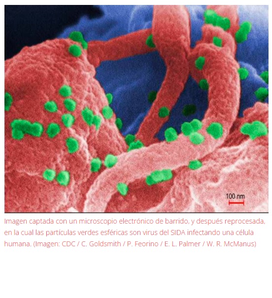 Edición Genética elimina el Virus SIV y abre la ruta hacia la cura del SIDA