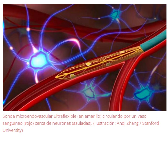 Dispositivo administrado a través de vasos sanguíneos para registrar la actividad de una sola neurona