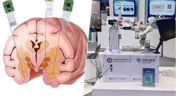 China ya tiene su primer implante BCI llamado Neuroscroll